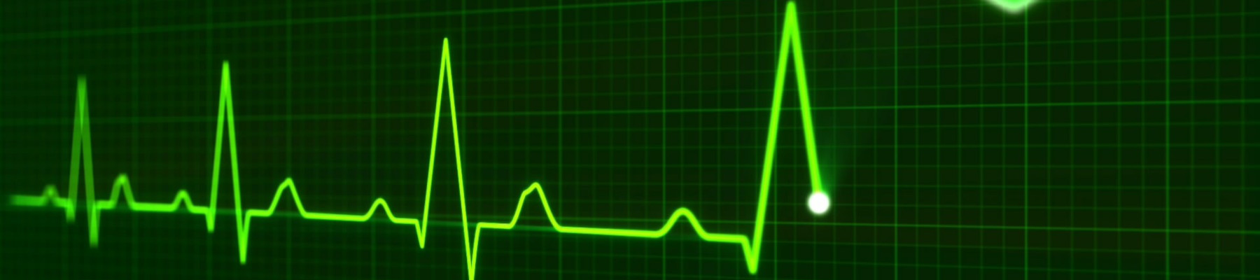 grüne Linie auf schwarzem Monitor, Aufzeichnung eines EKG